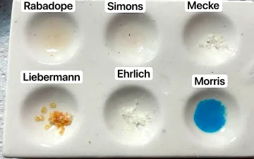 Falsi positivi nei test della cocaina