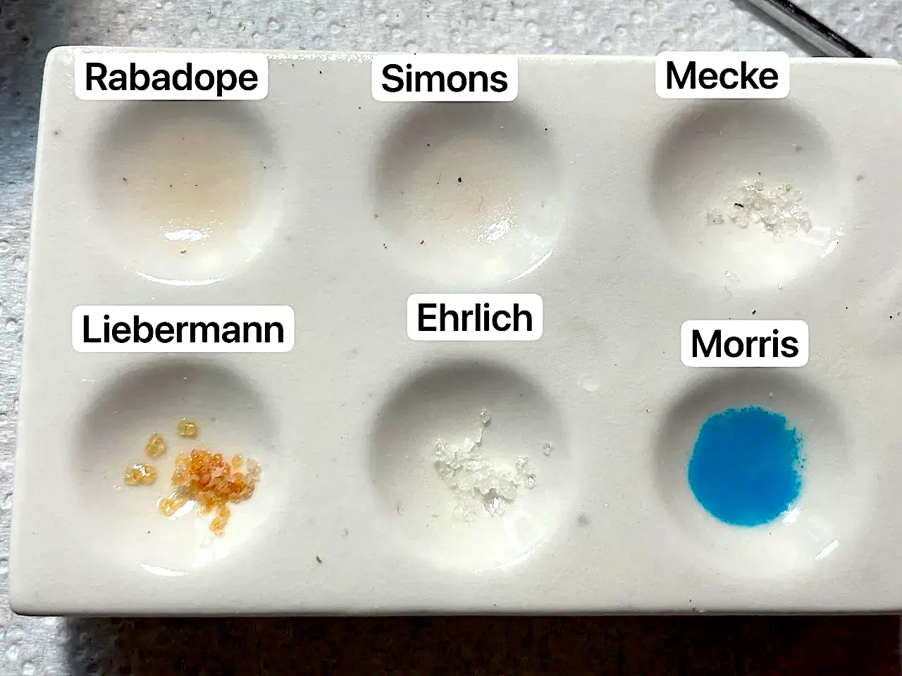 Falsi positivi nei test della cocaina