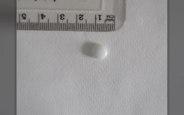 Pillole Bensedin