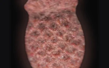 Pillole Pina (Ecstasy / MDMA)
