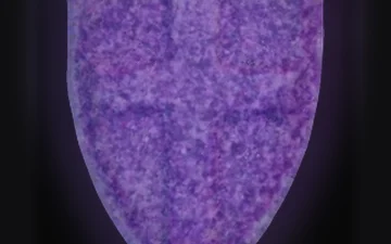 Pillole Wien Oida (Ecstasy / MDMA)