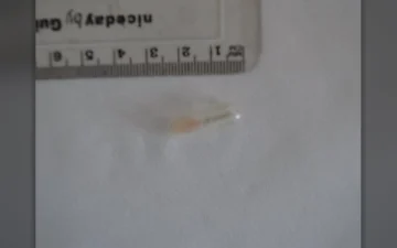Pillole Galenika Rivotril (Clonazepam)