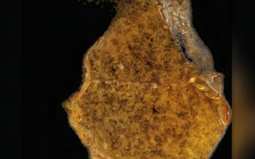 Olio di cannabis delta-8
