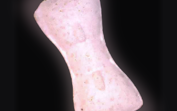 Pillole Gleich Wie Vorderseite (Ecstasy / MDMA)