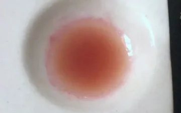 Mephedrone (risultati di analisi di campioni diversi)